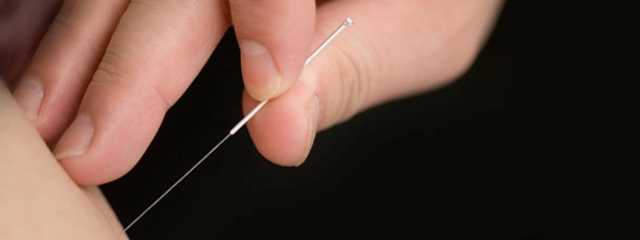 Acupuncture 06