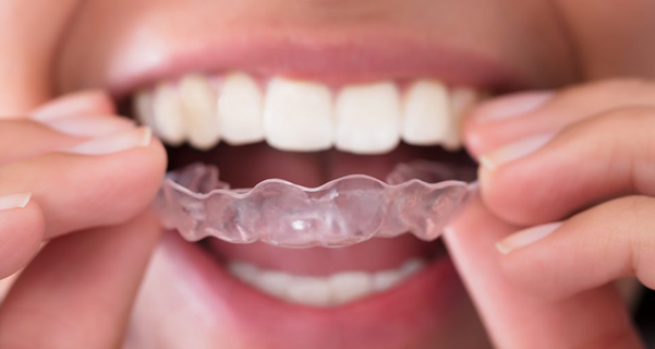 dental health